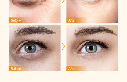 Hydrating Eye Cream Roller – Reduces Wrinkles, Puffiness & Dark Circles