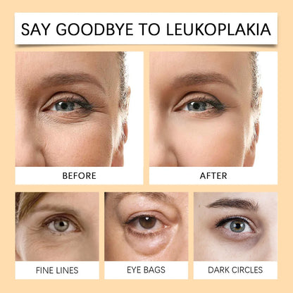 Nourishing Moisturizing Hydrating And Fading Eye Fine Lines Care Eye Skin Eye Cream Stick